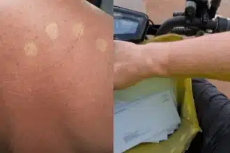 Australia Post Halts Uniform Rollout After Sunburn Complaints