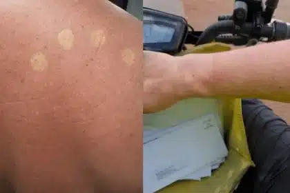 Australia Post Halts Uniform Rollout After Sunburn Complaints