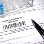 Wave Life Sciences Regains Global Rights to AATD Therapy WVE-006