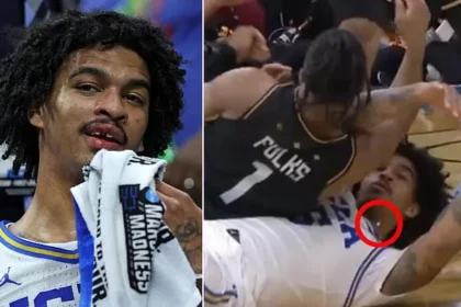 UCLA Guard Loses Tooth in March Madness Clash, Returns to Seal Win