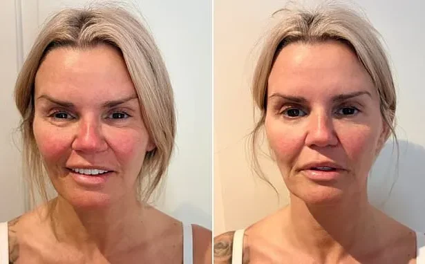 Kerry Katona Shares Energy Healing Results After Stroke Scare
