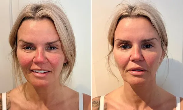 Kerry Katona Shares Energy Healing Results After Stroke Scare