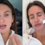 Ferne McCann Unveils Jaw and Forehead Botox Results Post 2-Stone Loss