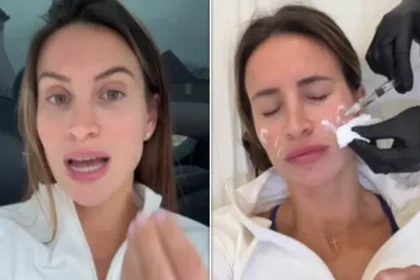 Ferne McCann Unveils Jaw and Forehead Botox Results Post 2-Stone Loss