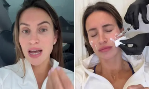 Ferne McCann Unveils Jaw and Forehead Botox Results Post 2-Stone Loss